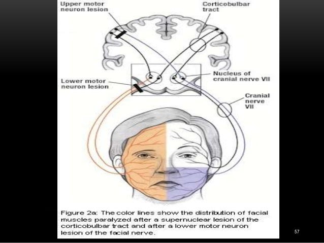 facial motor nerve Escort service westchester ny